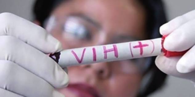 BENI REGISTRA MÁS DE 2.100 CASOS DE VIH